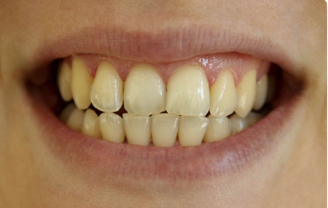 Aspen Dental Care